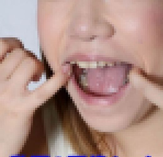 みさとちゃんの歯★★動画＆特典画像！★★