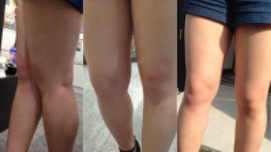真っ白エロ脚を露出するお買い物JDを接写地獄?