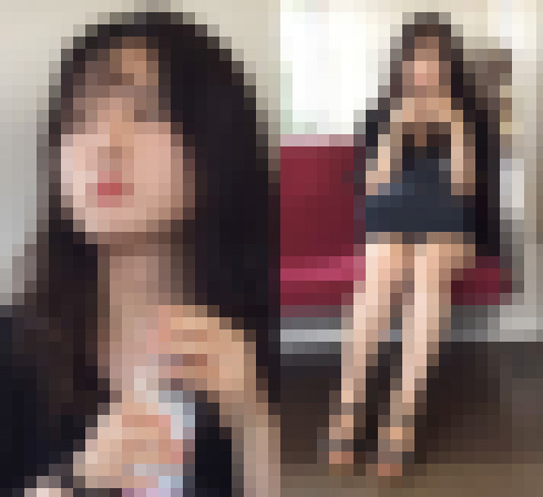 白くて綺麗な美脚に付いた傷が逆にそそる正統派美女（前編）