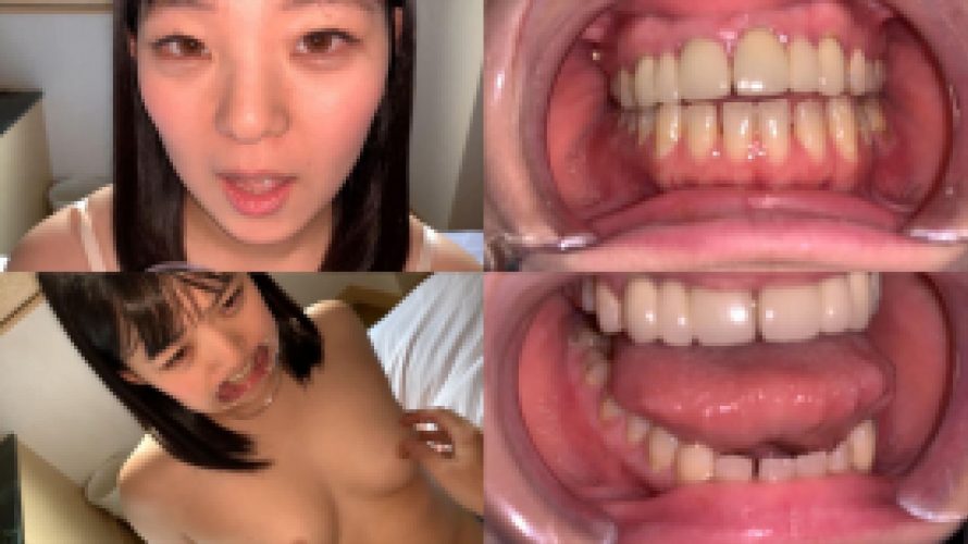 歯姫 18人目 [FBOM-00057]
