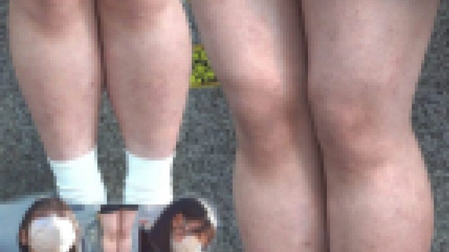 ヤバいぐらい鳥肌！かさかさボツボツ！ムチムチ生足の女の子を接写したよ 立ち姿編