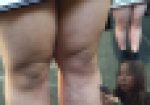 ナイスな鳥肌！ボツボツ ムチムチ生足の女の子を接写したよ